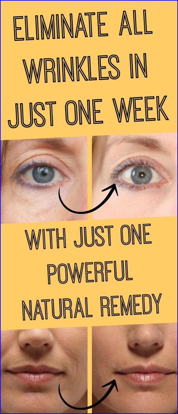 ELIMINATE ALL WRINKLES IN ONE WEEK WITH THIS POWERFUL NATURAL REMEDY